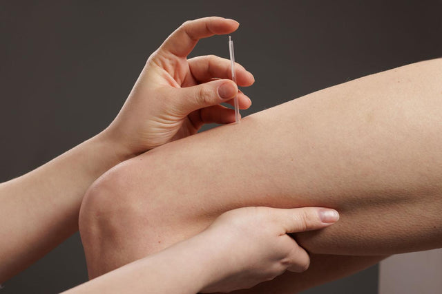 Dry Needling