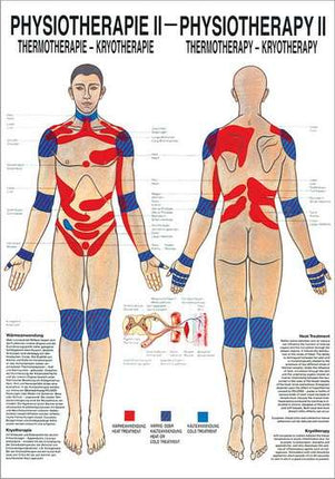 planche d´enseignement Physiothérapie II, 50 x 70cm, Thermo- & Cryothérapie, avec une fine barre métallique en haut et en bas