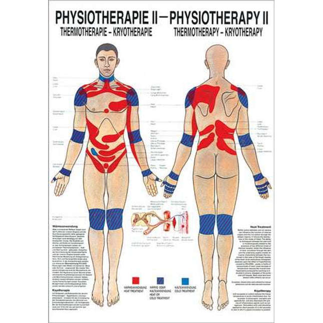 Poster Physiotherapy II, 50 x 70cm, Thermo- & Cryotherapy, with fine metal bar on top and bottom